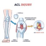 Orthopedic Treatment in Delhi