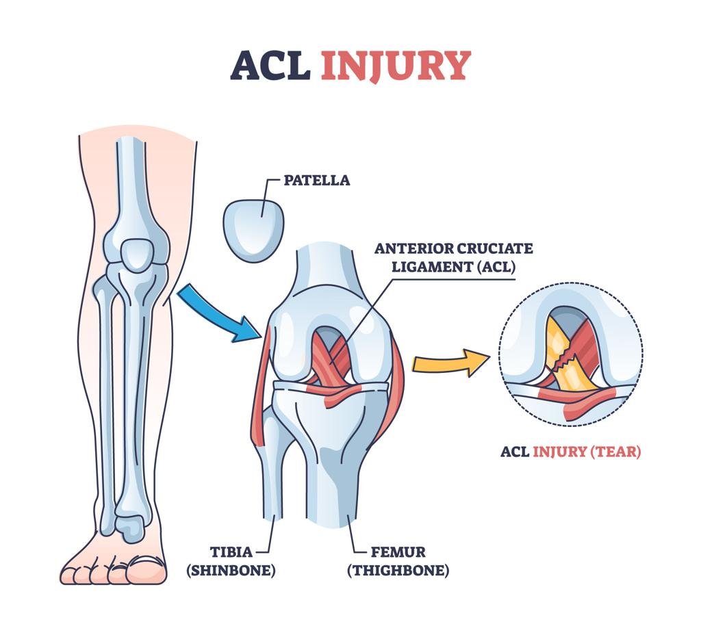 Orthopedic Treatment in Delhi